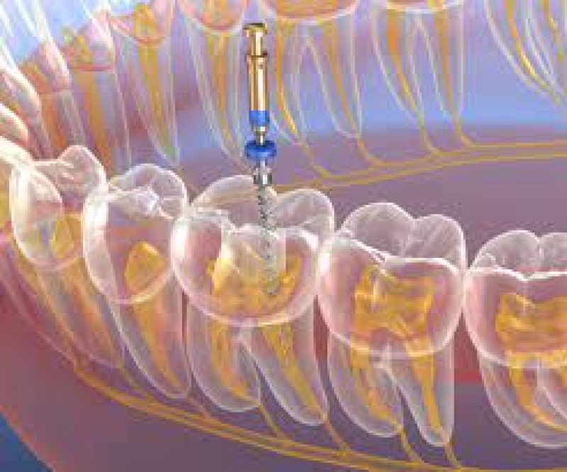 ENDODONZIA